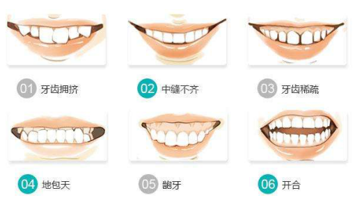 Can Jaw Deviation Be Corrected? Here's What Dr.Clear Aligner Says