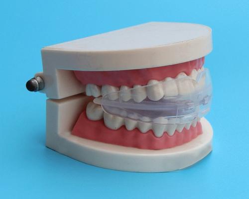 Clear Aligner Price