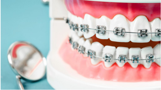 How Much Does Dr.Clear Aligner Treatment Cost