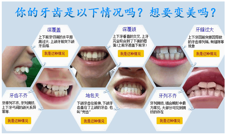 Is Dr.Clear Aligner Treatment Effective?